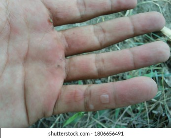 Callus on hand, left hand callus or callosity insensibility callousness on man left hand, callosity on labor hands