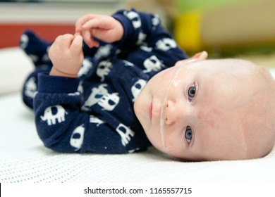 A Calm Baby With A Breathing Tube In Their Nose Receiving Medical Treatment.