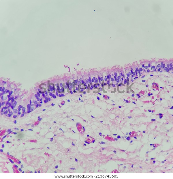 Camera photo of benign respiratory epithelium,
showing cilia along luminal surface, magnification 400x, photograph
through a microscope
