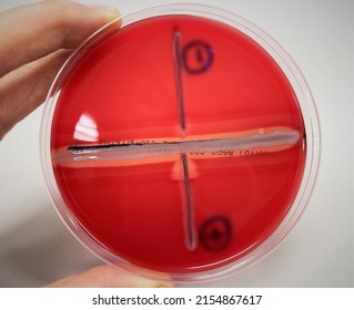 CAMP Test Positive Of Streptococcus Agalactiae On Sheep Blood Agar Plate In Close Up.