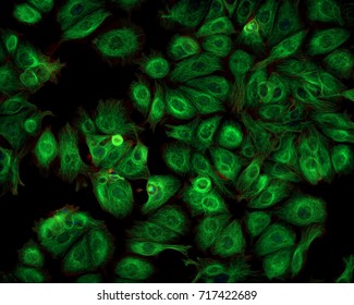 Cancer Cells imaged with a Fluorescence Microscope