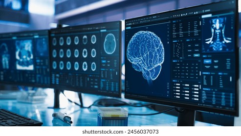 Cancer Research Center Medical Laboratory: Close Up of a Set of Desktop Computer Monitors Showing CT Scans Of Human Brain. Specialist Studying Brain Tumor, Finding Solutions, Treatment - Powered by Shutterstock