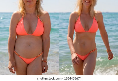 Candid photos of a woman before and after weight loss