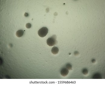 Candida Albicans Colonies Under Microscope Stock Photo 1559686463 ...