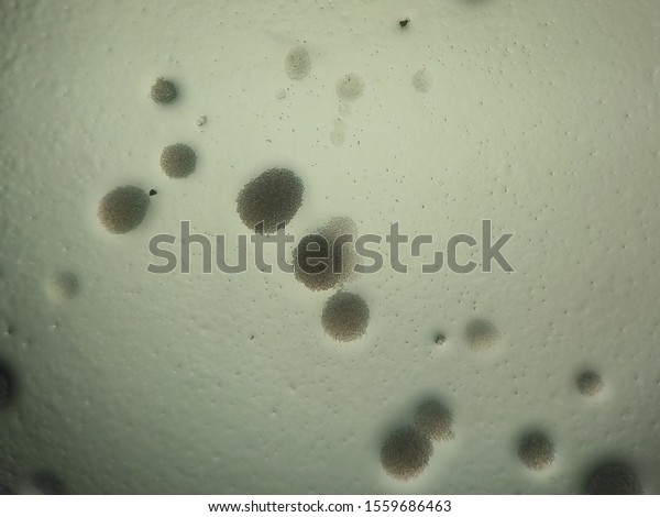 Candida Albicans Colonies Under Microscope Stock Photo 1559686463 ...