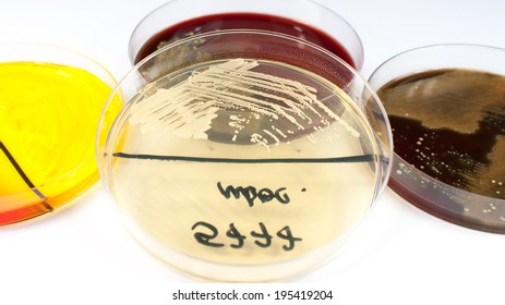 Candida Albicans Fungus On Petri Dish Stock Photo 195419204 | Shutterstock