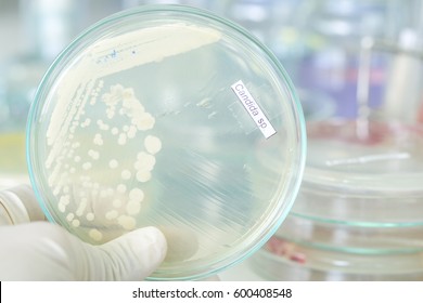 Candida Colony In Petridish With Microbiology Concept