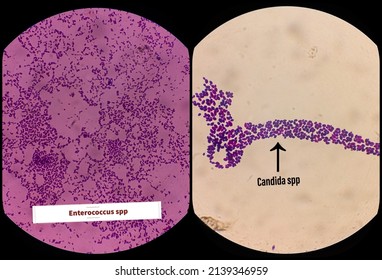 Candida Spp And Enterococcus Spp, Fungi, Emerging Multidrug Fungus. Candida Albicans, Yeast Fungi. Compare Cell.