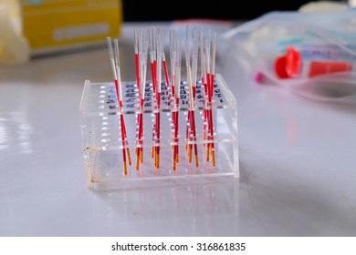 Capillary Tube And Clay In Hematology Laboratory