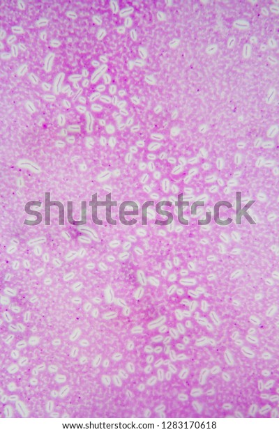 Capsule Stain Bacillus Bacteria Viewed 400x Stock Photo (Edit Now ...