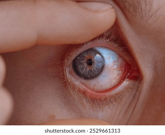 Capturing pupil movement during macro photography of the eyes.