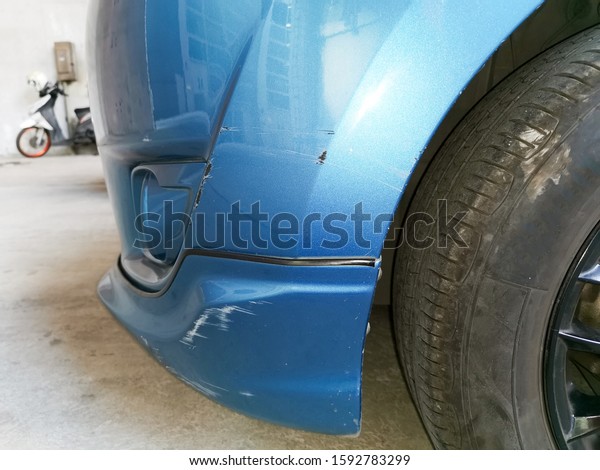 Car paint scratch close-up. Finger show scratch on blue\
car .