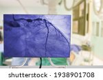 Cardiac Catheterization with Coronary Angiography on blurry  Cardiac Catherization Lab Room.Medical healthcare and Technology concept