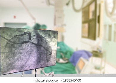 Cardiac Catheterization with Coronary Angiography on blurry  Cardiac Catherization Lab Room.
Medical healthcare and technology concept.