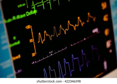 Cardiac Monitor Operating Room Stock Photo (Edit Now) 422346598