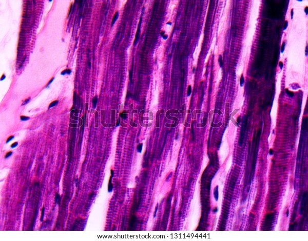Cardiac Muscle Fibers magnified 400x showing\
striations and intercalated\
disc\'s\
