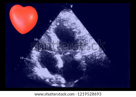 cardiac ultrasound images small heart screen stock photo edit now