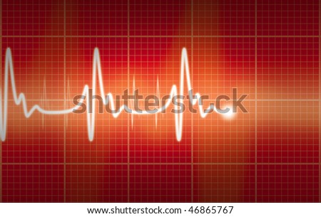 cardiogram