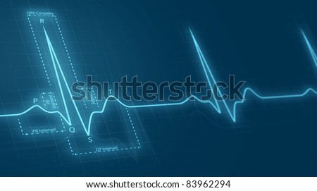 cardiogram