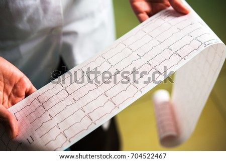 cardiogram close-up in doctors hands