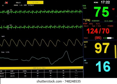 Cardiogram On The Life Support Monitor In The Critical Care Unit