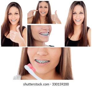 Care Your Teeth. Photo Sequence Of Girl With Brackets