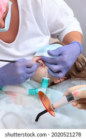 Caries Treatment Of Primary Teeth Under General Anesthesia. Surgery Under General Anesthesia. A Child Under General Anesthesia.Breathing Tube During Surgery.Vertical Photo.