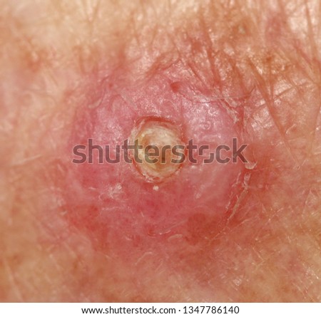 Similar – umbilicus Fluff Navel