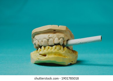 Cast Of Teeth And Cigarette On A Light Blue Background. Smoke And Damage