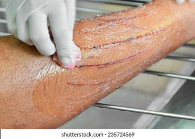 Cat Bite Wound Scrub