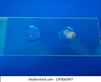 The Catalase Test For Bacterial Identification; Negative And Positive Results In Close Up.