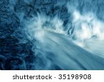 cataract