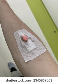Catheter inserted into the arm before the MRI. Picc (Peripherally Inserted Central Catheter) in the arm. Picc can be used for long-term chemotherapy, antibiotic therapy, or total parenteral nutrition