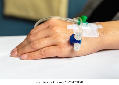 A catheter into the back of hand vein 