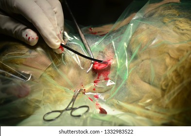 Catheter In The Jugular Vein In A Dog Under Heartworm Extraction Surgery