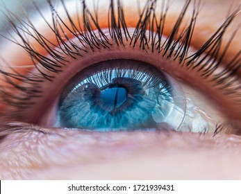 Caucasian Human Blue Eye In A Contact Lens Looking Up Close Up. Contact Lens Vision Medical Correction Concept