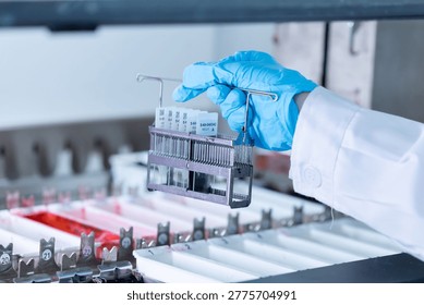 Caucasian laboratory pathologist using automatic multi slide stainer machine in a laboratory