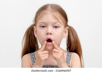 Caucasian little girl of 6 years with open mouth and fingers on mouth corner. To show impaired articulatory motility and muscle tone as form of dysarthria.