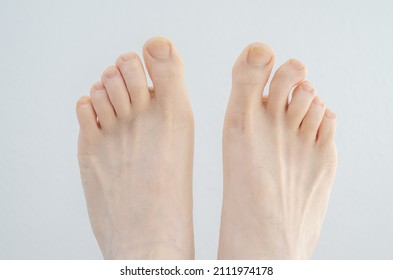 Caucasian Male Bare Feet. Close Up Shot, Isolated On White Background, Top View.