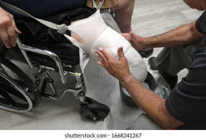 A Caucasian Male Prosthetist Making A Mold Of The Residual Limb (artificial Leb) Of An Amputee Sitting In A Wheelchair.