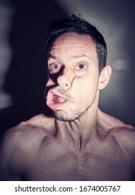 
Caucasian Man Face Deformed By A Punch