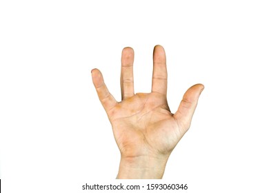 Amputated Finger High Res Stock Images Shutterstock