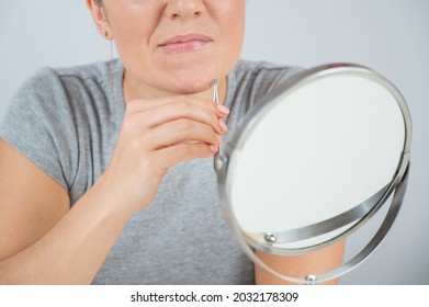 Caucasian Woman Looks In The Mirror And Removes Hair On Her Chin Herself With The Help Of Tweezers. Hirsutism.