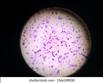 The Cell Apoptosis