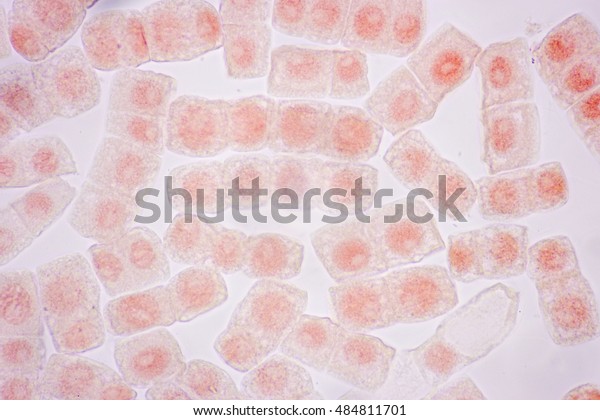 Cell Division and Cell Cycle in plant under\
the microscope