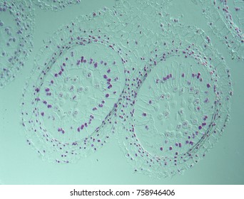 Cell division stages under the microscope