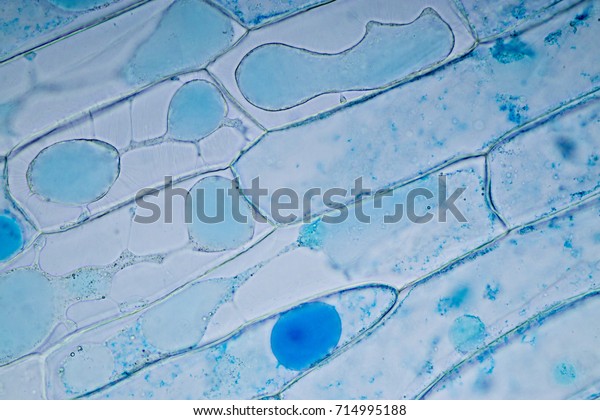 Cell structure plant (onion) showing under the\
microscope classroom\
education.