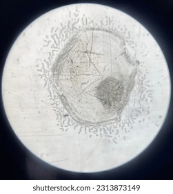Cells of a fish scale under the microscope.