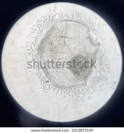 Cells of a fish scale under the microscope.