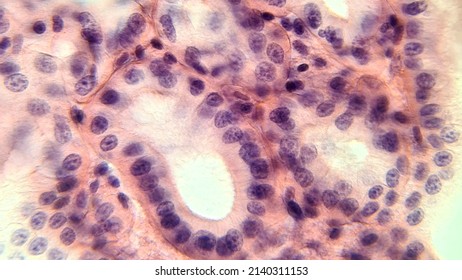 Cells of glandular epithelium, microscopic photo of permanent preparation